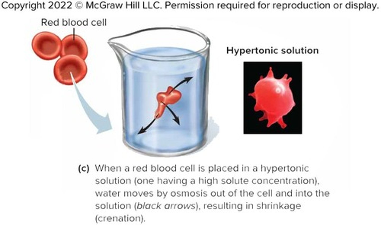 <p>A solution with higher osmotic pressure; cells in a hypertonic solution lose water.</p>