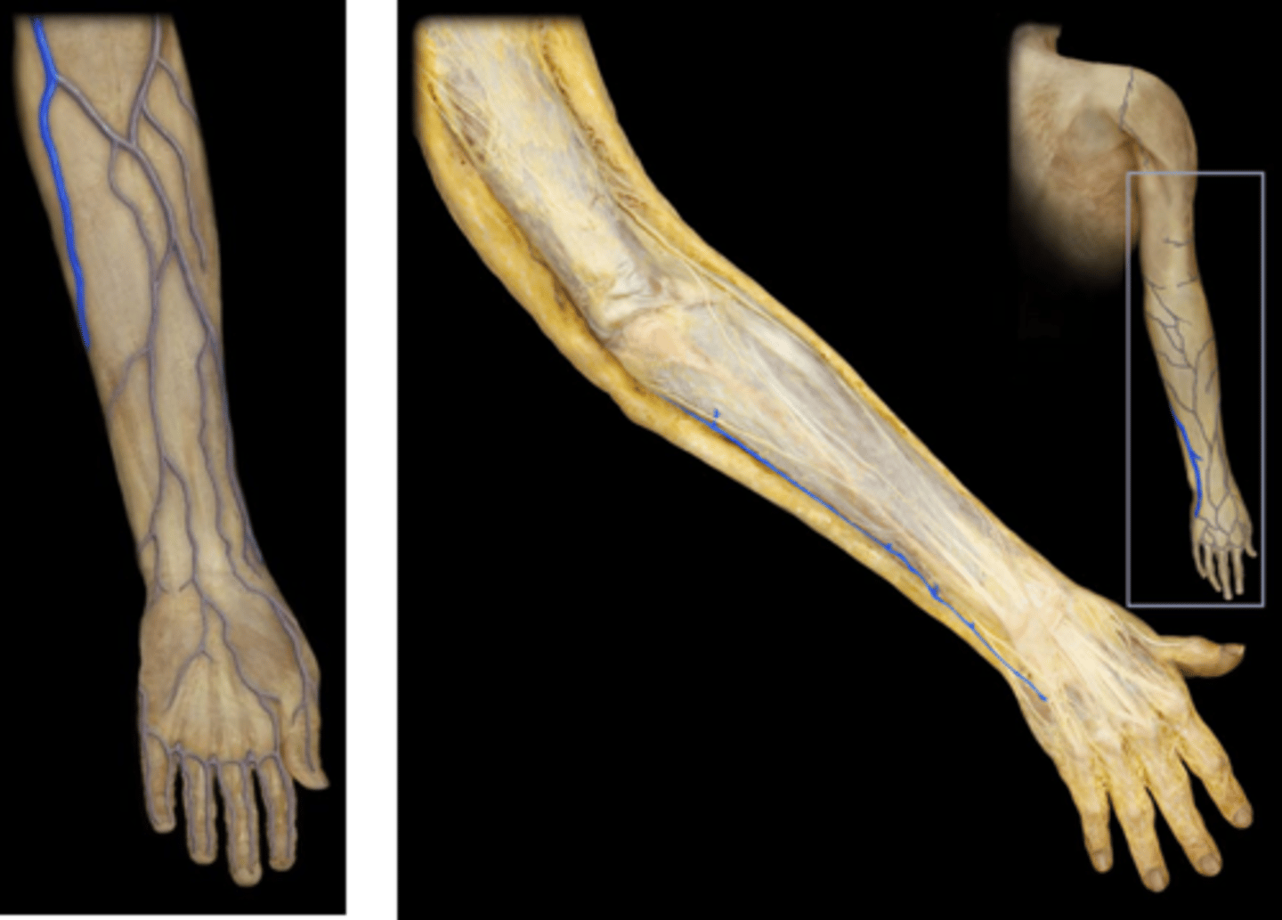 <p>Name these vessels.</p>