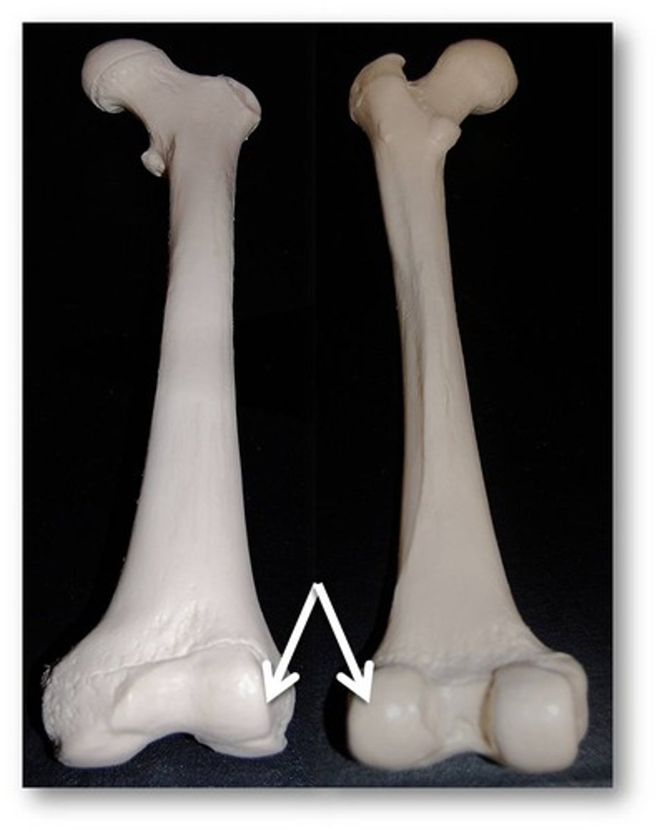 <p>Name this specific part of the femur.</p>