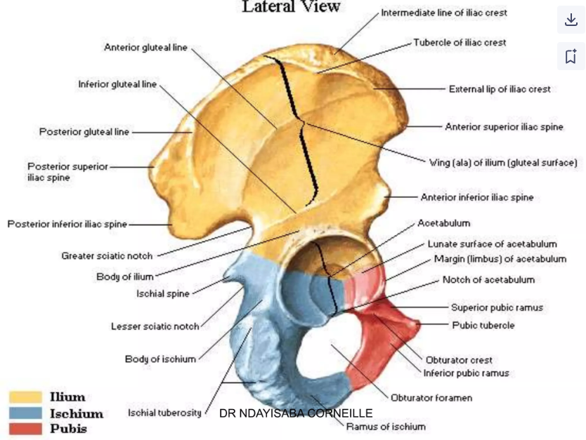 <p>The _______ ramus of the pubis joins the _______ and _______  at the acetabulum.</p>
