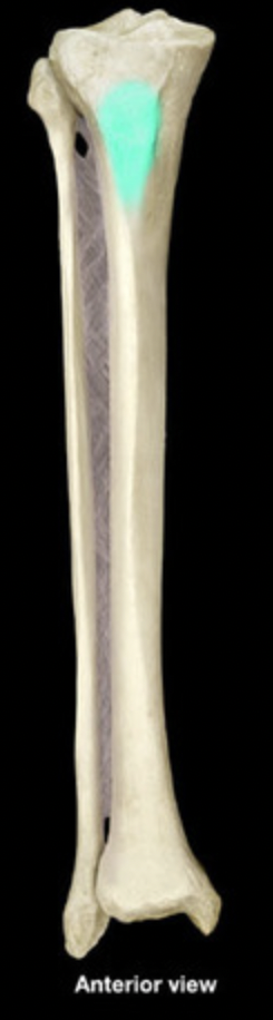 <p>Tibial tuberosity</p>