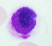 <p>What WBC is this?</p>