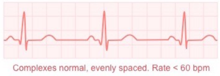 <p>What ECG trace is this?</p>
