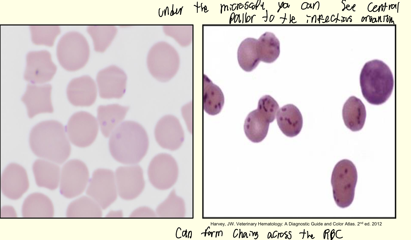 <p>What infectious organism of RBCs is this?</p>