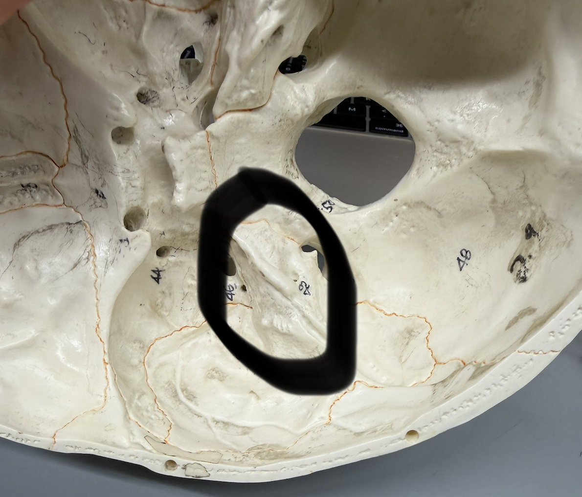 <p>(stone, rock)- “rocky” part of bone that contributes to cranial base; mini mountain ridge between occipital bone and sphenoid bone seen inside articulated skull</p>
