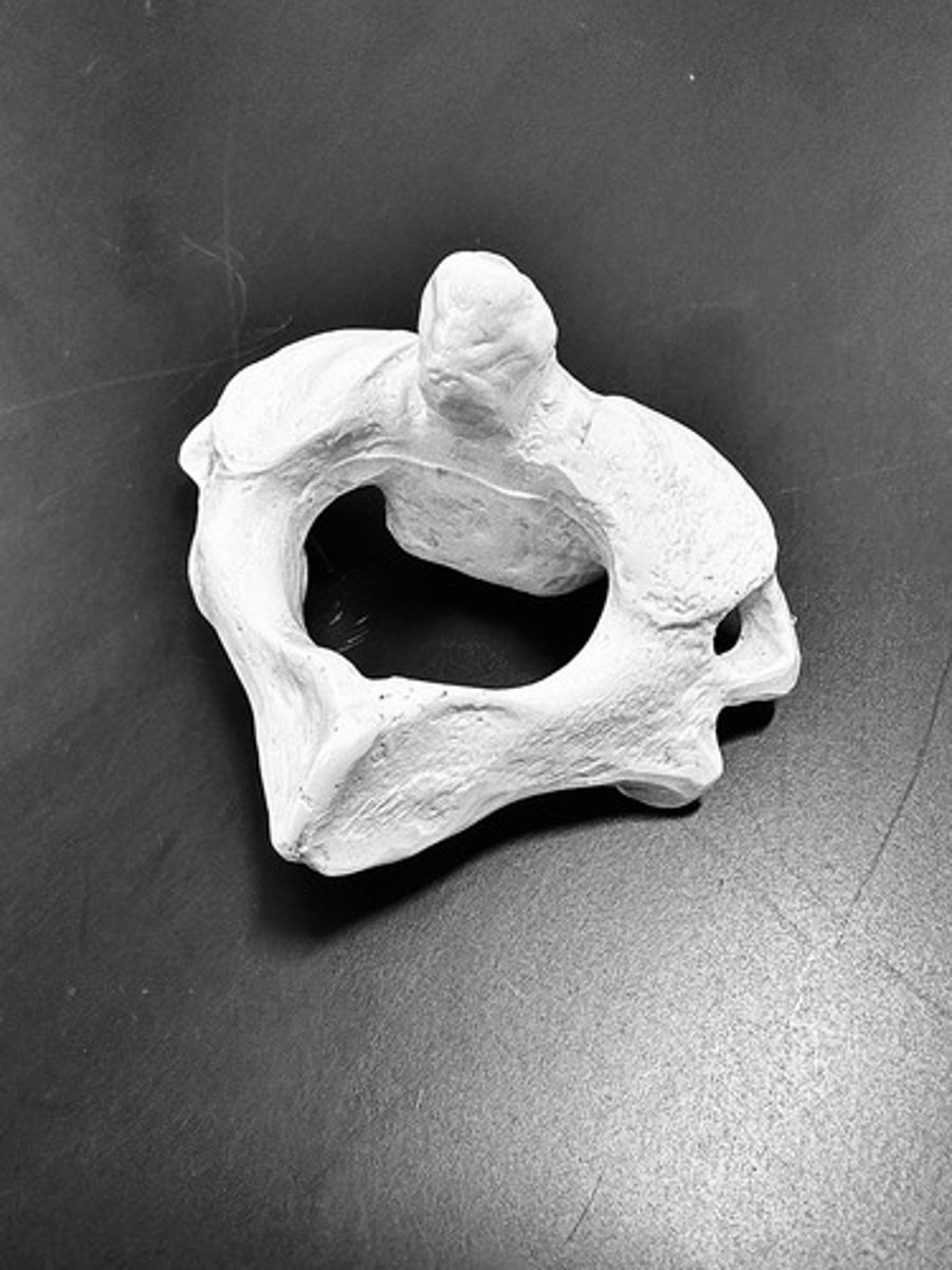 <p>The name for the second cervical vertebrae (C2)</p>