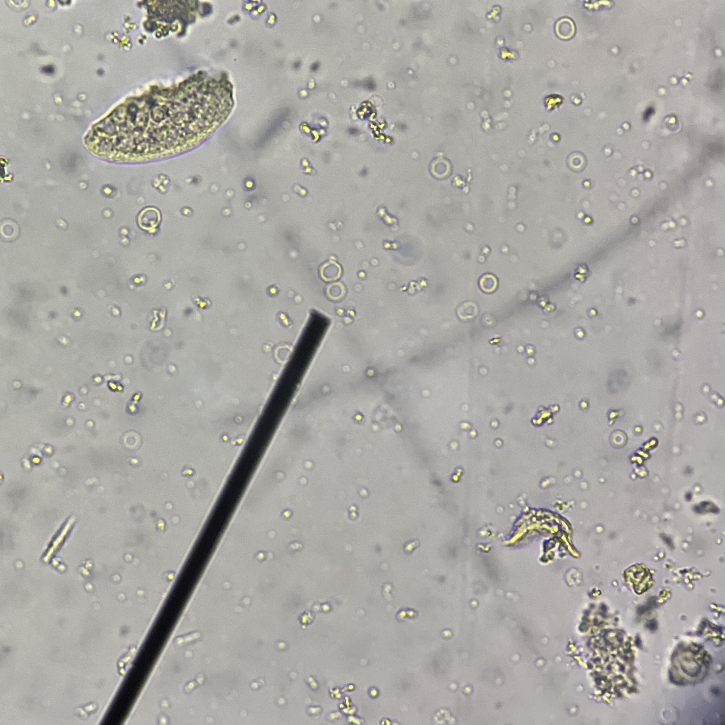 <p>How can you differentiate the pointed structure from the other sediment that is morphologically the same with it?</p>