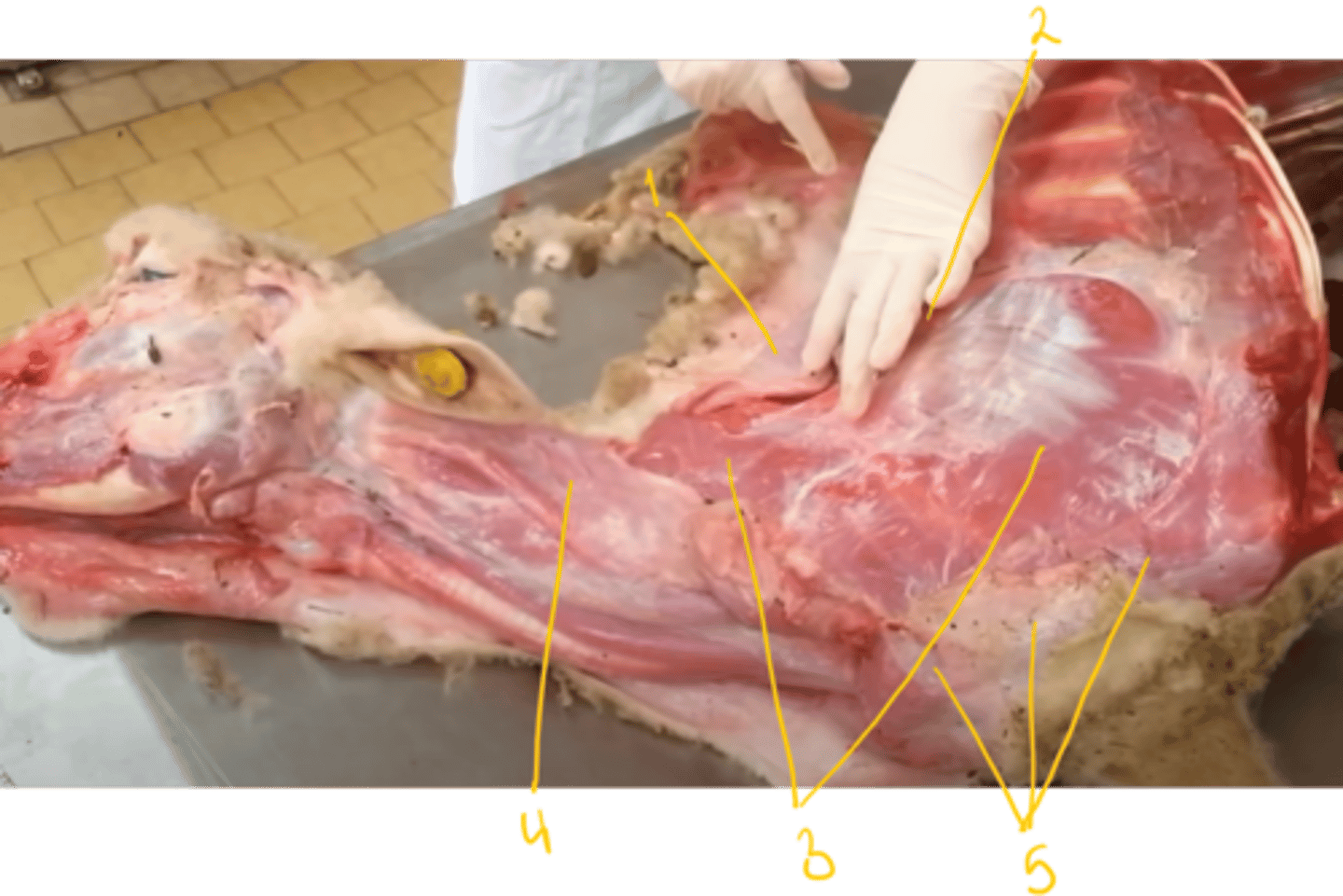 <p>Identify these muscles. What is their function? (overview)</p>
