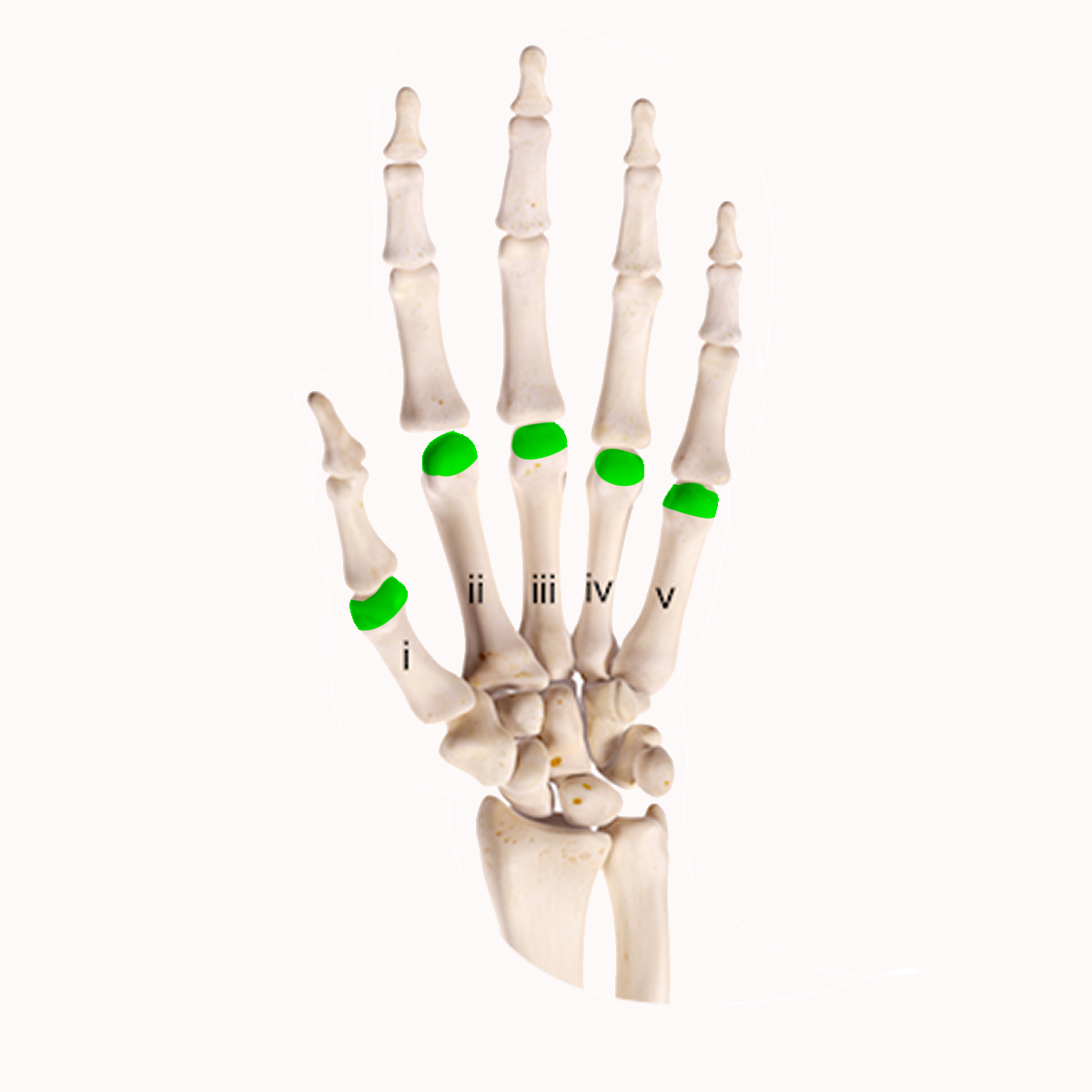 <p>The the highlighted part of the metacarpal</p>