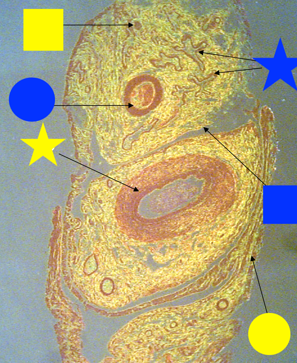 <p>What structure is being indicated by the overall image?</p>