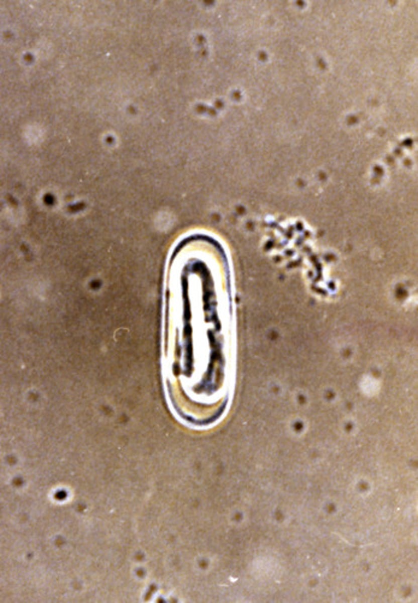 <p>Oesophageal worm of dogs which is also an important factor in the development of esophageal sarcoma.</p>