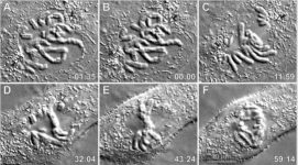 <ul><li><p>interference patterns → enhance contrast = high-contrast images of <u>living </u>organisms with (pseudo) 3D appearance</p></li><li><p>useful in distinguishing structures</p></li><li><p>enhances contrast in specimens with slight variations in thickness and refractive index</p><ul><li><p>USEFUL FOR THINK SPECIMANS</p></li><li><p>NO “halo” artifacts</p></li><li><p>expensive</p></li></ul></li></ul><p></p>