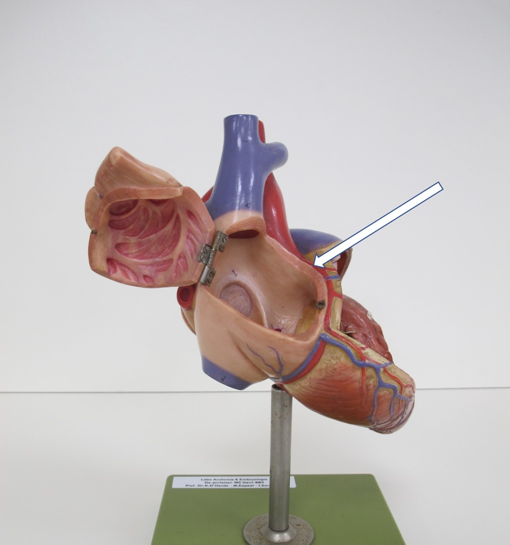 <p>bloedvat (Latijns + specifiek)</p>