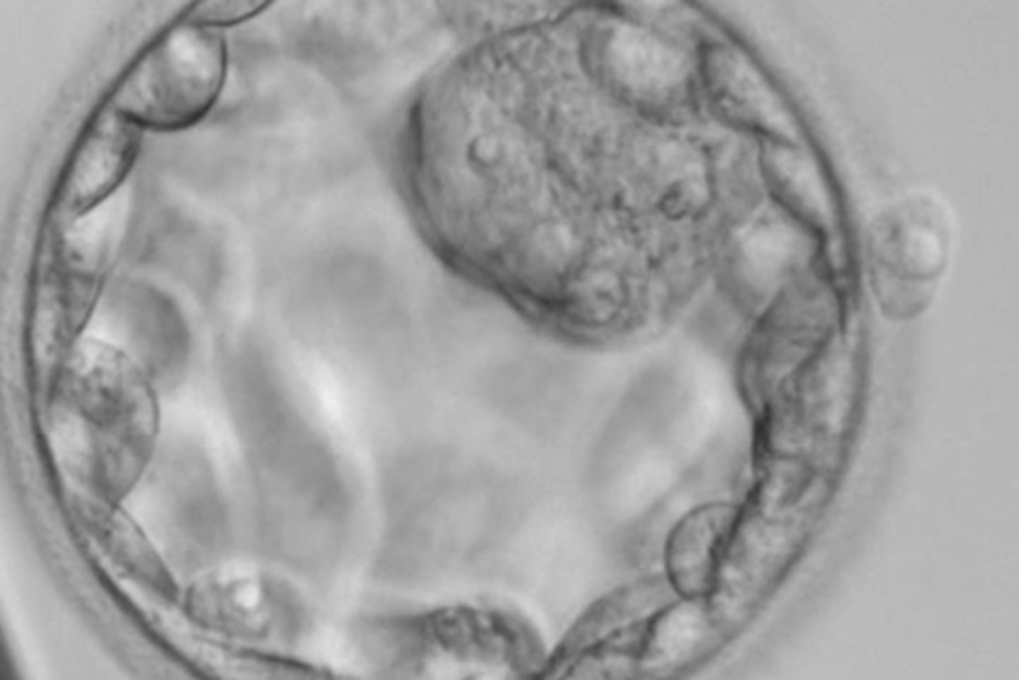 <p>identify the stage of fertilization:</p>