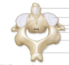 <p>Cervical vertebrae (C2)</p>