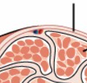 <ul><li><p>External sheath of connective tissue surrounding the whole muscle</p></li><li><p>separates whole muscles from one another</p></li><li><p>covered by fascia</p></li></ul><p></p>