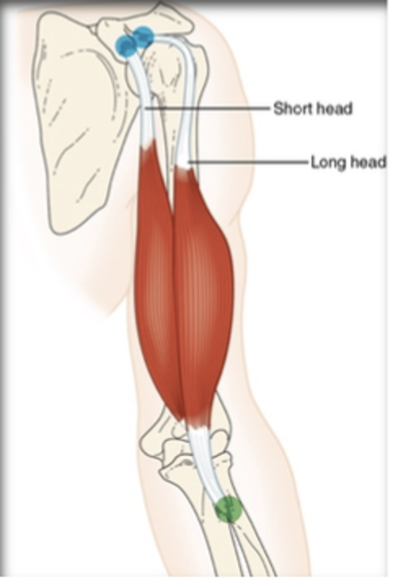 <p>What muscle is this?</p>