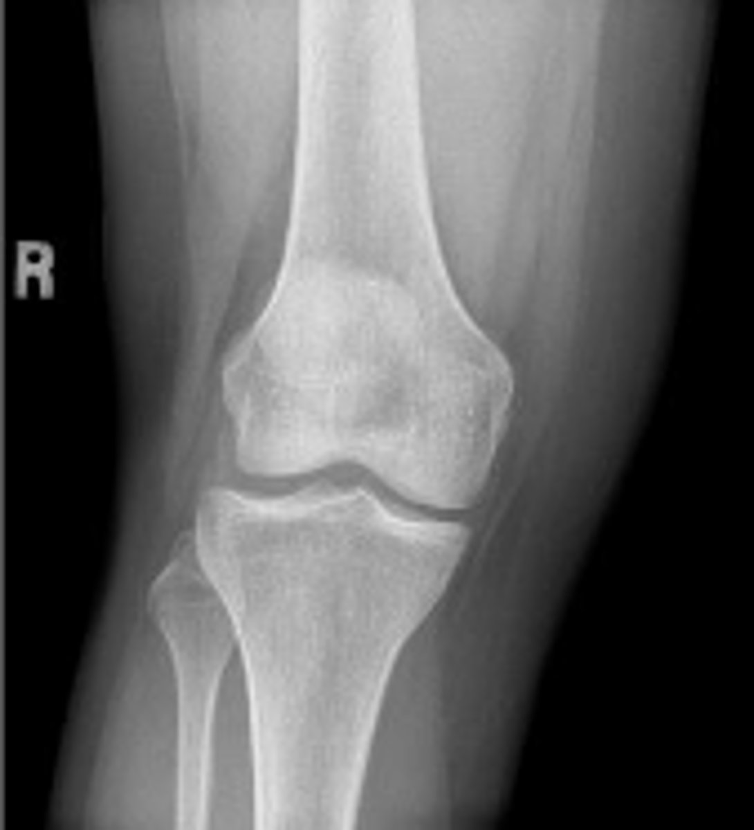 <p>What is the name of the radiographic view?</p>