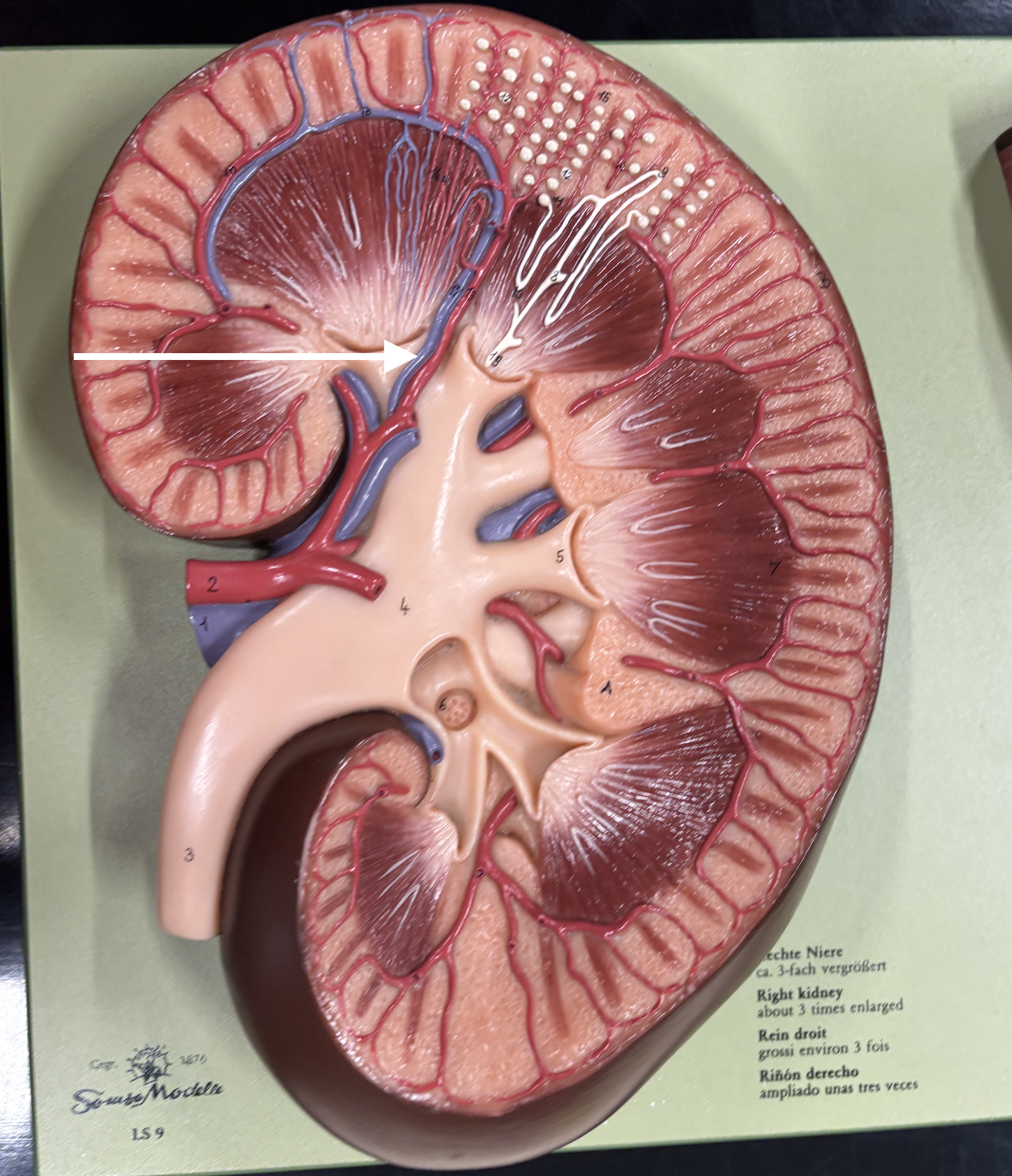 <p>what structure is the arrow pointing to? *vein*</p>