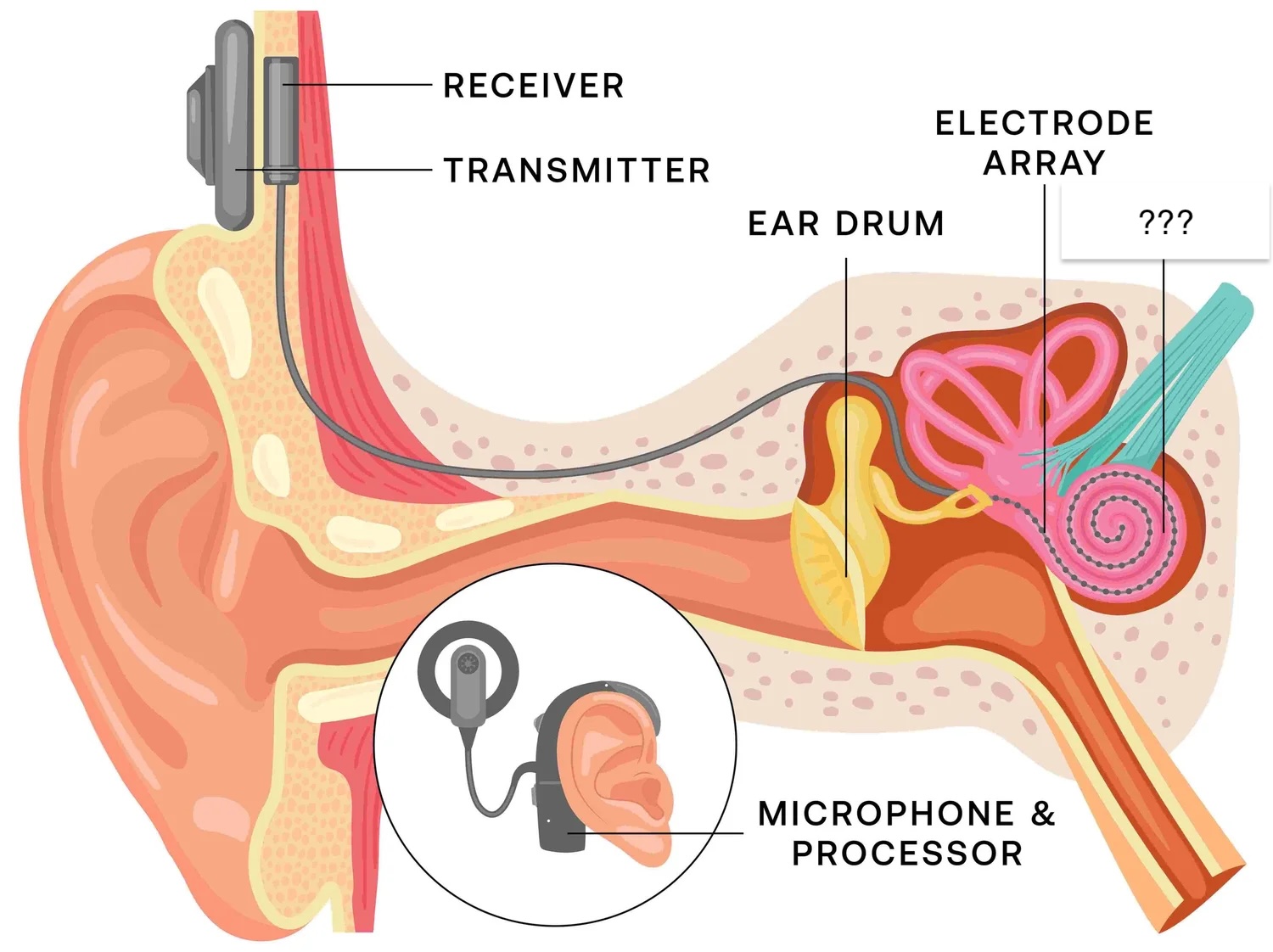 <p>coiled, bony, fluid-filled tube in the inner ear. waves that travel through the fluid trigger nerve impulses</p><p>there are little hairs in the fluid and when they move, they activate nerve cells</p>