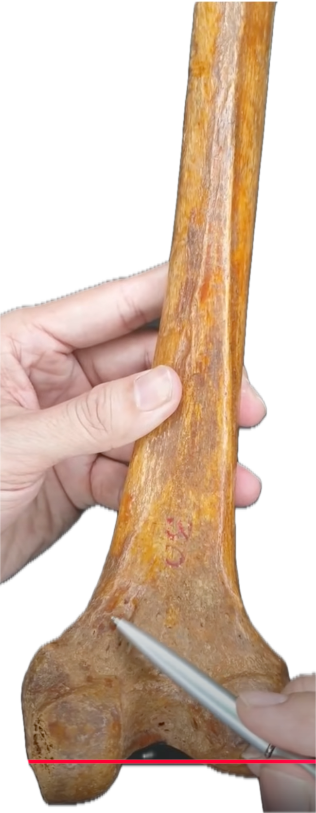 <p><span style="color: red"><strong>ADDUCTOR TUBERCLE</strong></span></p>