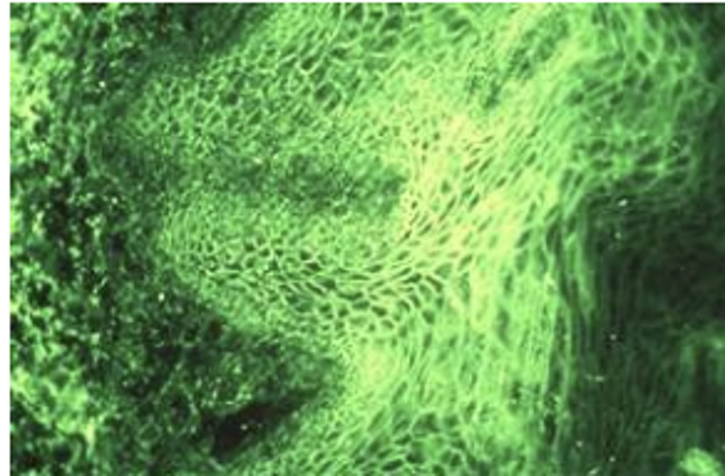 <p>Blistering in this disease is due to antibodies directed against component of ___? (picture showing histo slide with intraepithelial split)</p>