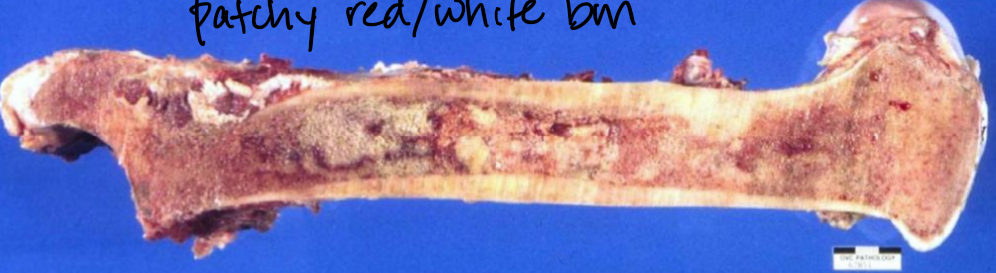 <p>What is this, and what causes it</p>