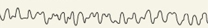 <p>Which category of brain wave is:</p><ul><li><p>Children & frustrated adults</p></li></ul><p></p>