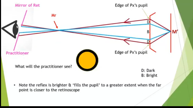 <p>as the practitioner gets closer to the far point more of the pupil s filled </p><p></p>