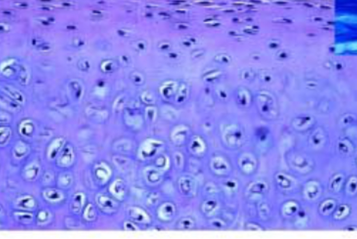 <p>Hyaline (cartilage)</p>