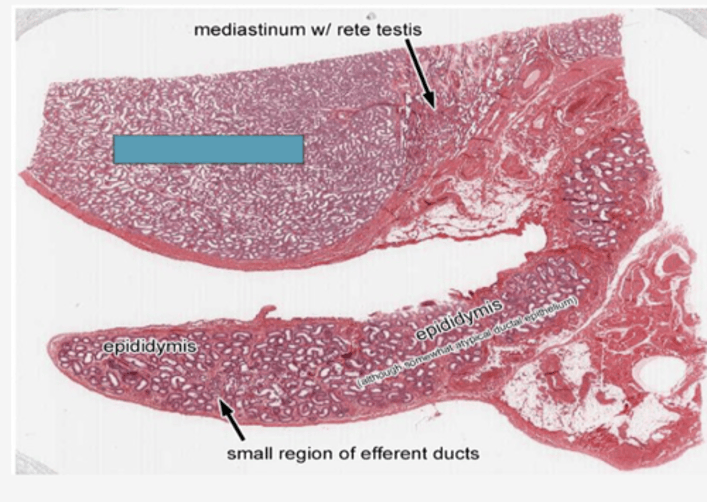 <p>Identify the structure</p>
