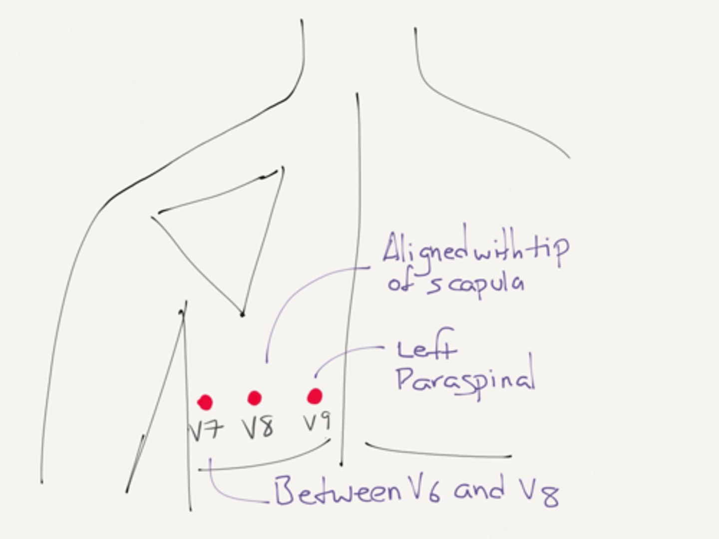 <p>Lead V9</p>
