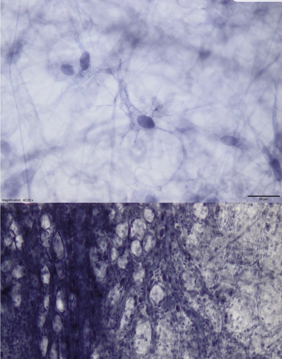 <p>Kas sudaro puruji kolagenini jungiamaji audini?</p>