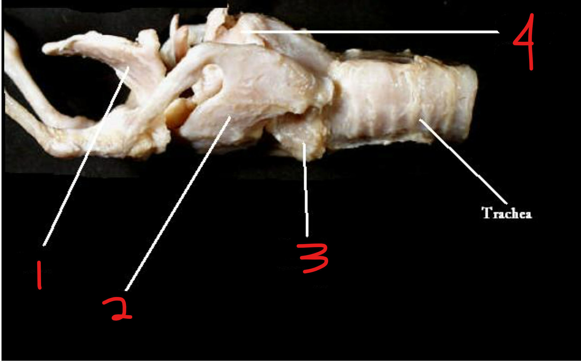 <p>label the cartilages of the larynx</p>