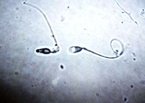 1. progressive motility - greater than 30% mobile
2. morphology - greater than 70% is normal
3. concentration - 1200M/mL
4. volume - 5-10mL per ejaculate