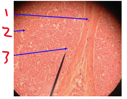 <p><span>Name the white surrounding the dot at 3</span></p>