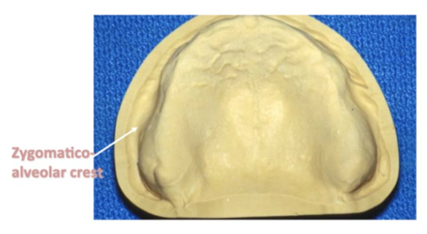 <p>the crest has been likened to the buccal shelf in the mandible as a stress bearing area.</p>