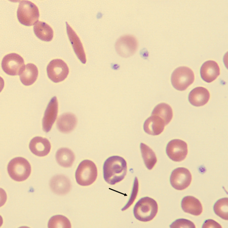 <p>What is the shape of this erythrocyte?</p>