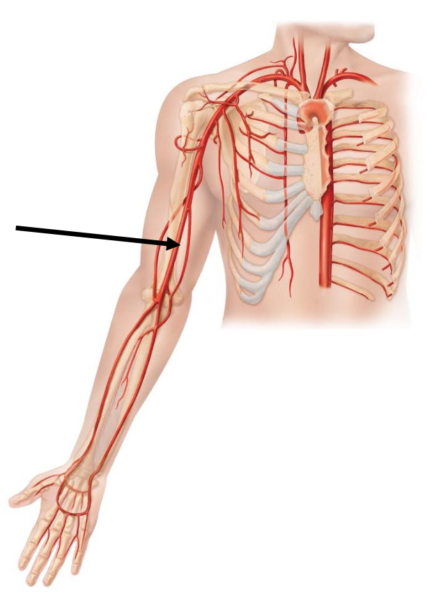 <p>The arrow is pointing to </p><p></p><p>a. Brachiocephalic trunk</p><p>b. Brachial artery</p><p>c. Radial artery</p><p>d. Ulnar artery</p>