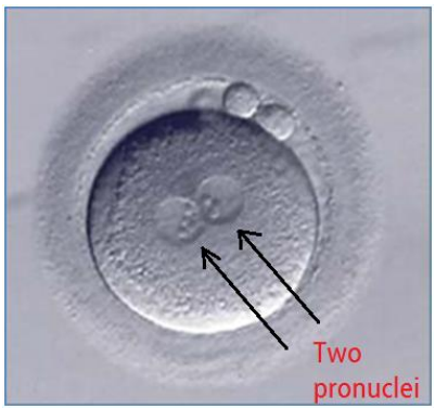 <p>genetic material of the fertilised zygote, one of maternal &amp; one of paternal origin &gt; in humans each contain 23 chromosones that give rise to 46 total</p>
