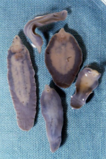 <p>common liver fluke</p>