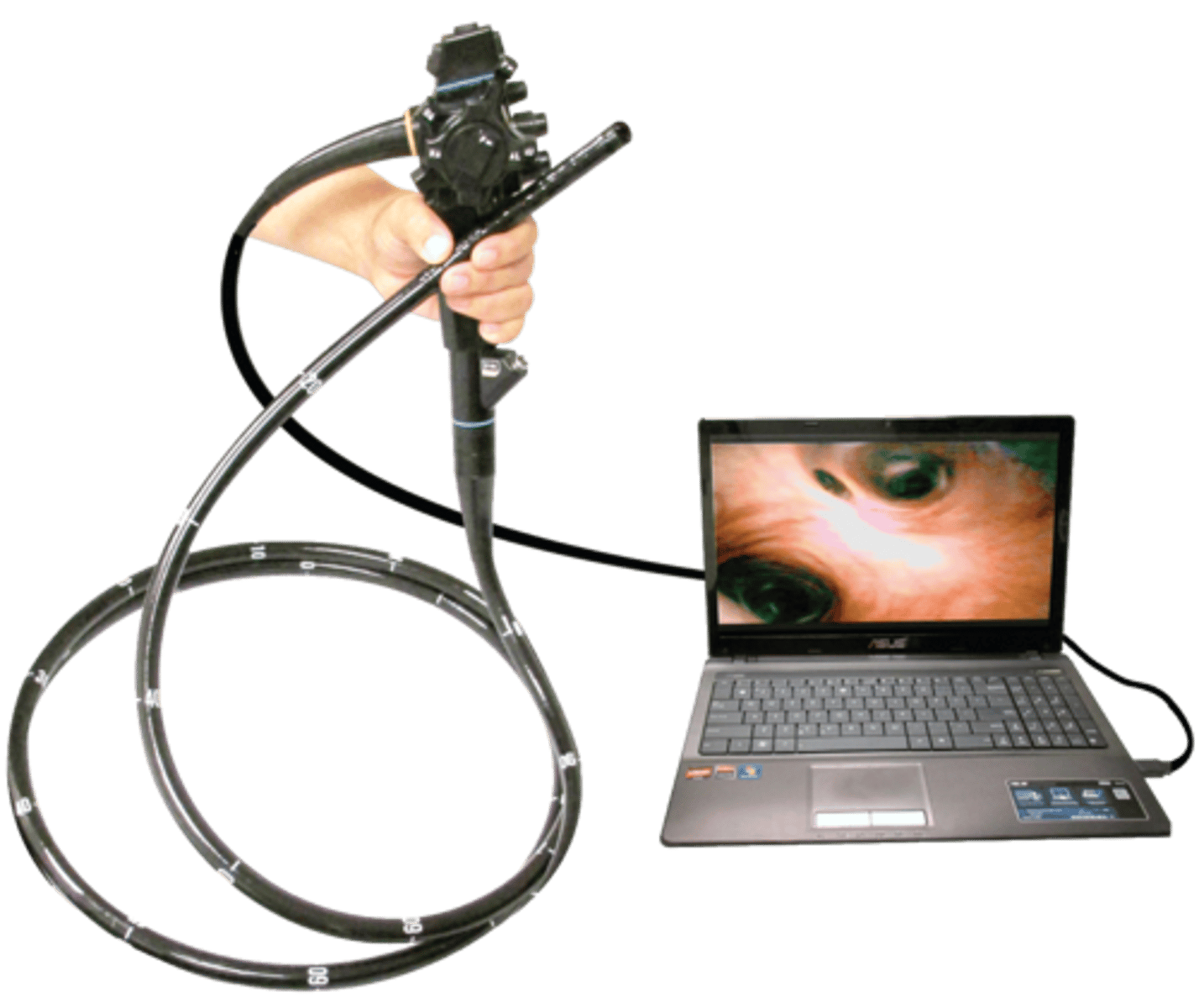 <p>an instrument used to examine the interior of a hollow organ or body cavity</p>