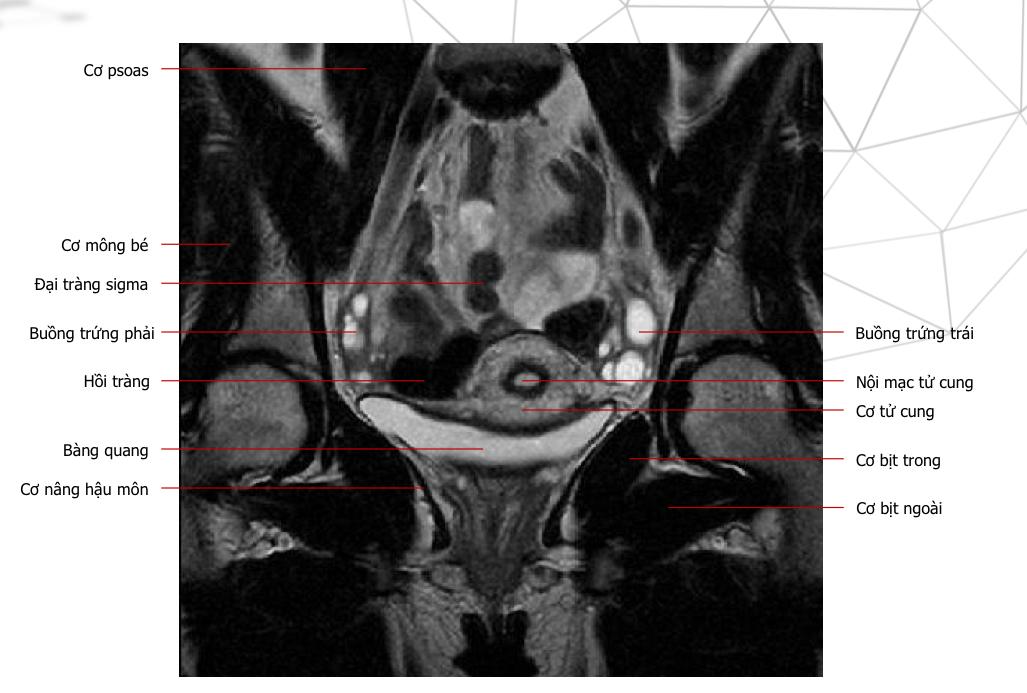 <p>T2 cor, thì nghỉ</p>