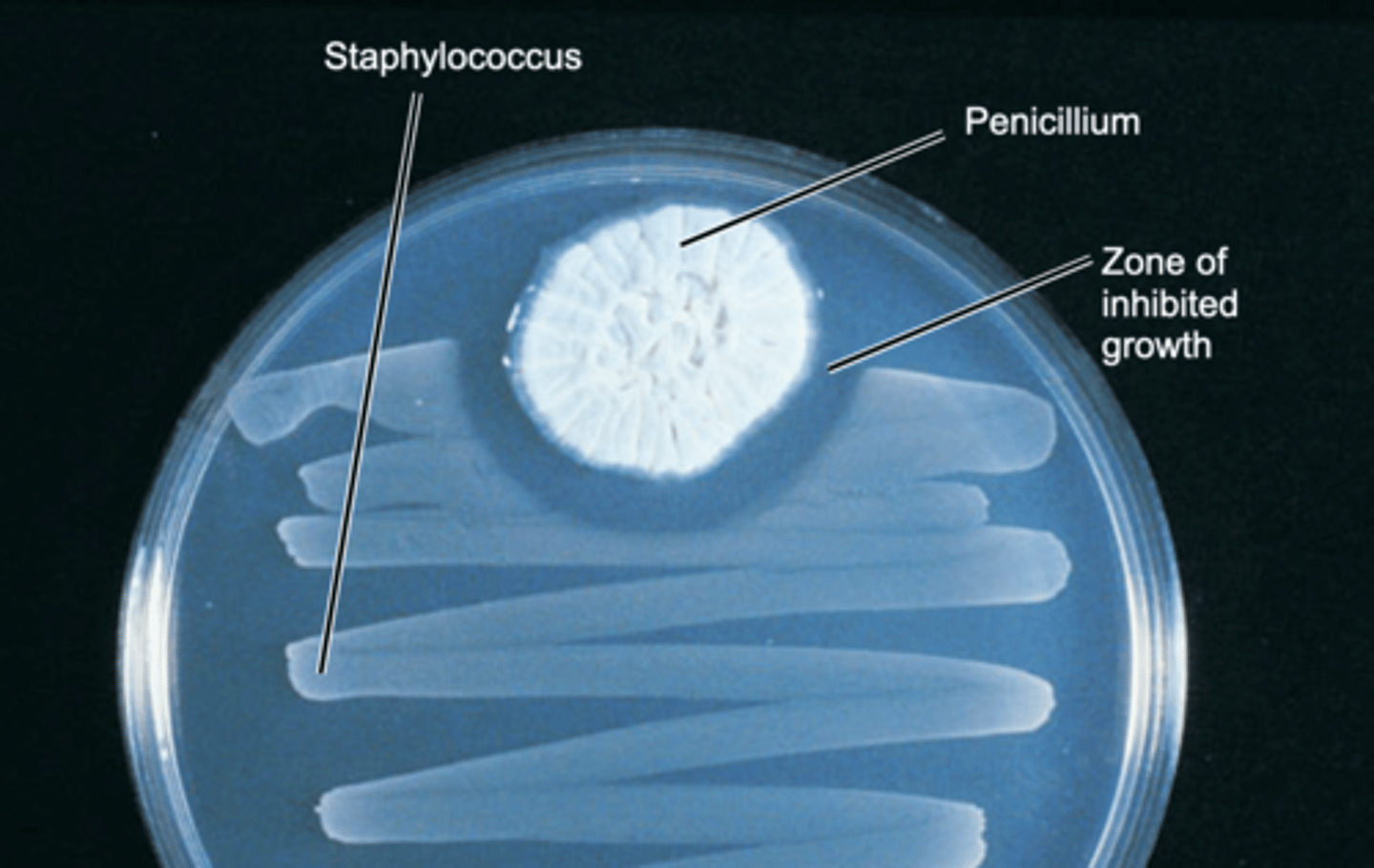 <p>kills bacteria growing nearby</p>