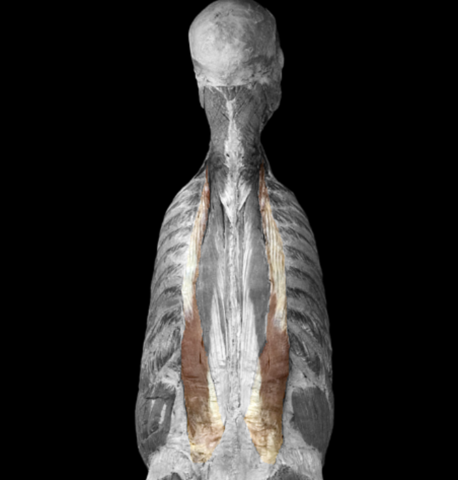 <p>What muscle is this?</p>