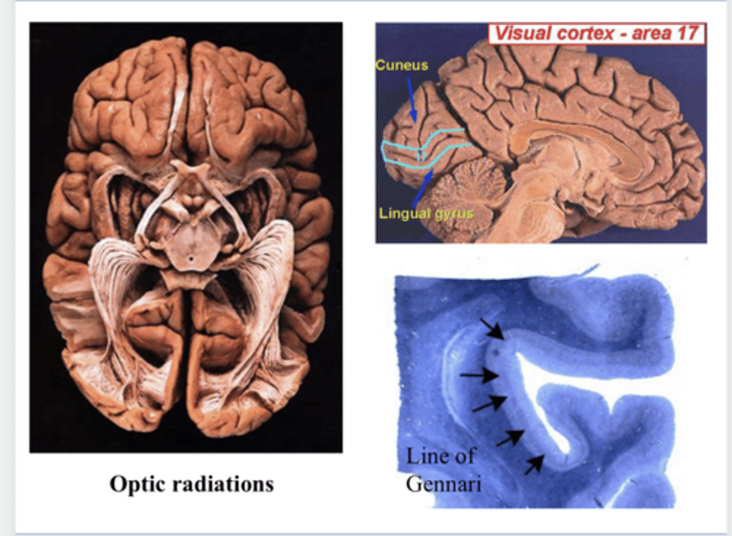 <p>Optic Radiations (Pic)</p>