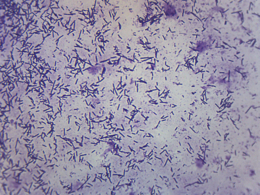 Escherichia coli