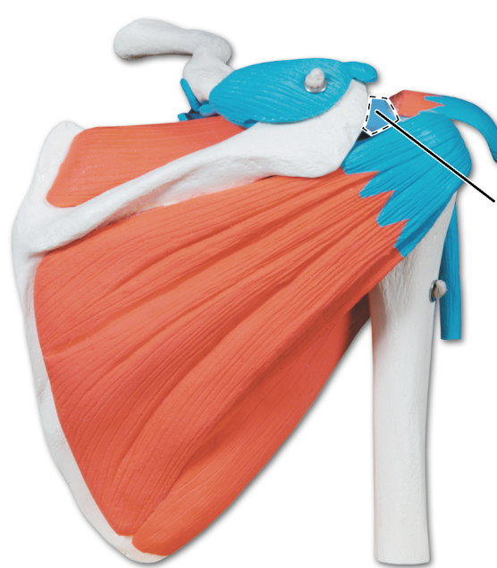 <p>What ligament is shown here?</p>