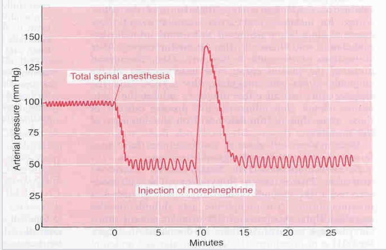 <p>What does this graph demonstrate? </p>