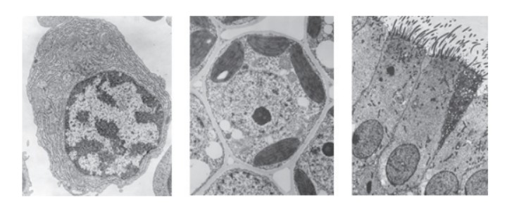 <p>What feature distinguishes striated muscle fibres from the three cell types shown in the images?</p>